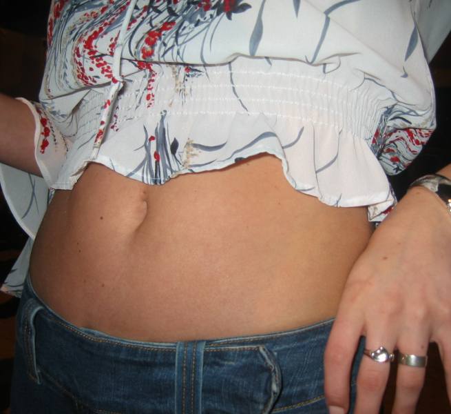 belly button day years ago